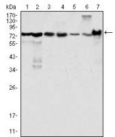 LPP antibody [8B3A11]
