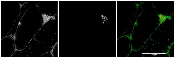 MYO5A antibody, Internal