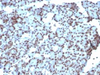SUMO1 antibody [SUMO1/1188]