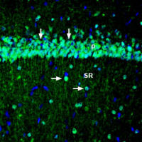 Kv7.3 / KCNQ3 antibody