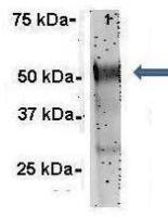 G3BP1 antibody, N-term