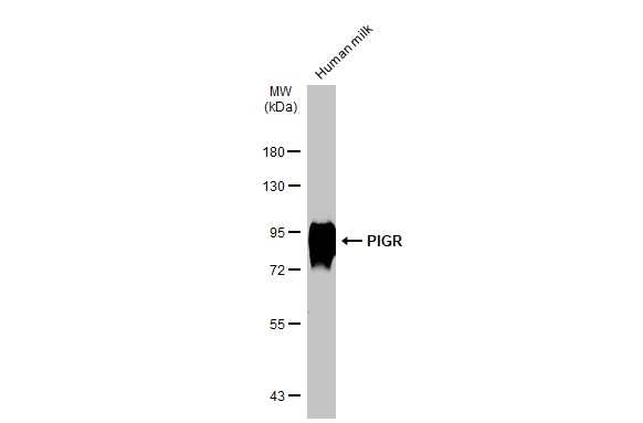 PIGR antibody [N2C1], Internal