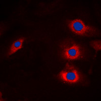 NEDL2 antibody