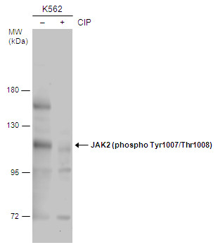 JAK2 (phospho Tyr1007/1008) antibody