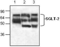 SGLT2 antibody