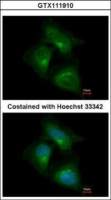 CDK5RAP1 antibody