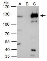 HLTF antibody [N2C1], Internal