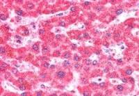 CMG1 antibody, C-term