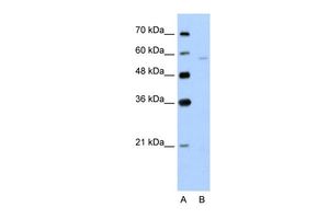 SLC22A7 antibody, N-term