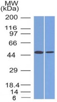 FOXA1 antibody [FOXA1/1512]
