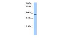 ALKBH8 antibody, N-term