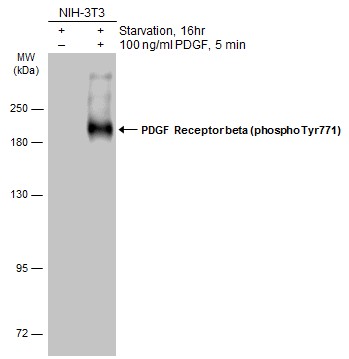 PDGF Receptor beta (phospho Tyr771) antibody