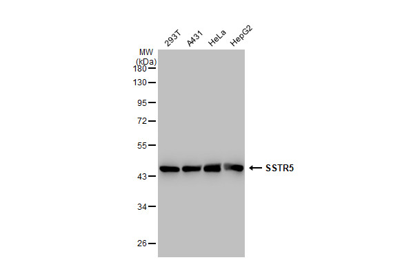 SSTR5 antibody [GT1315]