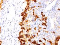 p75 NGF Receptor / CD271 antibody [IHC637]