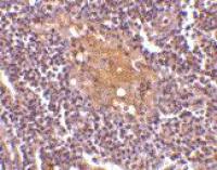 CD5L antibody, C-term