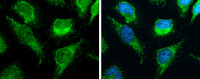 RBFA antibody