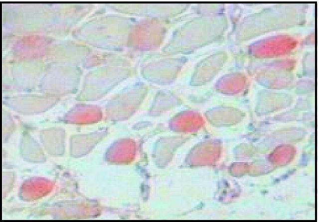 Myosin skeletal slow antibody [NOQ7.5.4D]
