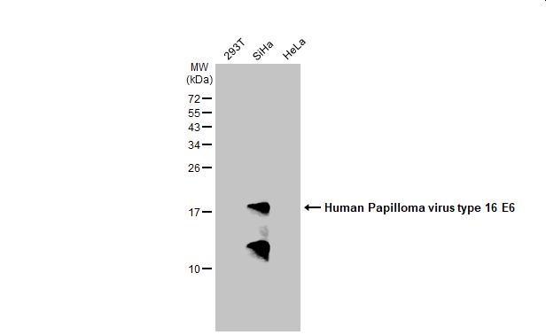 Human Papillomavirus type 16 E6 antibody