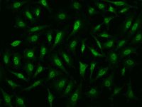 NIPP1 antibody