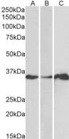 LASP1 antibody