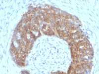 TFF1 antibody [SPM313]