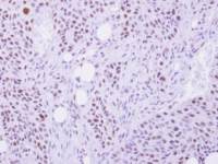 Selenophosphate synthetase 1 antibody