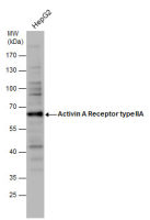 Activin Receptor Type IIA antibody [C1C3]