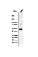CD38 antibody [CD38/4247R]