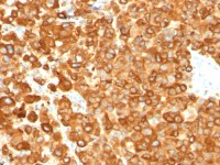 Melanoma gp100 antibody [PMEL/783]