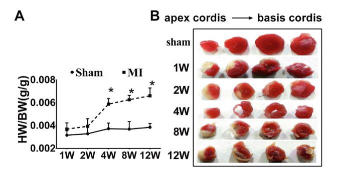 低氧/厌氧产品案例——低氧与心梗研究2