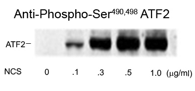 ATF2 (phospho Ser490/498) antibody