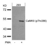 CaMKII alpha (phospho Thr286) antibody