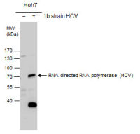 Hepatitis C virus NS5B protein antibody