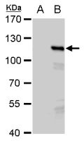 PMS2 antibody [N1N3]