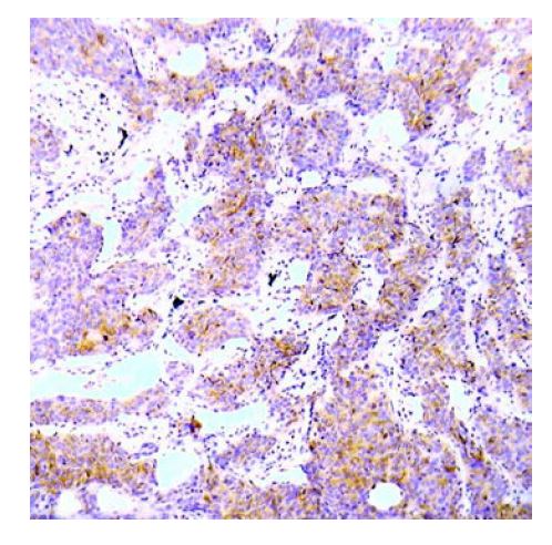 ALK (phospho Tyr1586) antibody