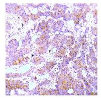 ALK (phospho Tyr1586) antibody