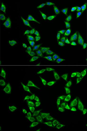 TSSC3 antibody