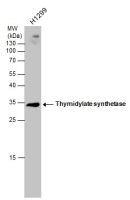 Thymidylate synthase antibody [N3C3]