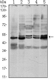 SMAD3 antibody [5G11]