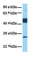 PIK3IP1 antibody, Internal