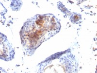 FOXP3 antibody [FXP3/197]