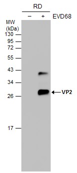 Enterovirus D68 VP2 antibody