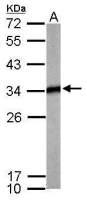 Tropomyosin 4 antibody