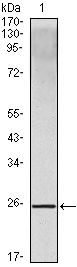 IL10 antibody [3C12C12]