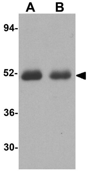 Caspase 2 antibody