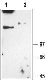 CLCN1 antibody