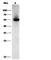 ALDH1A1 antibody [5G9E6C9]