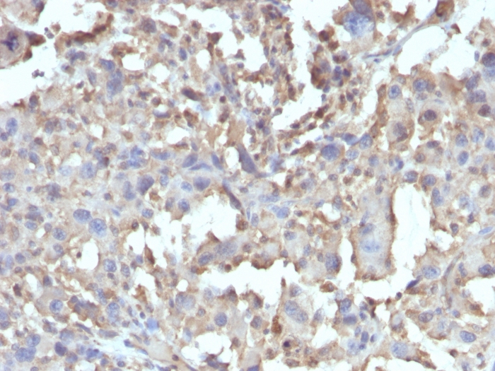 TNF alpha antibody [TNF/1500R]