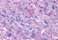 Glucagon receptor antibody