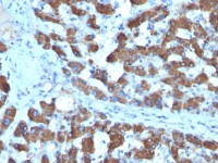 CPS1 antibody [SPM615]